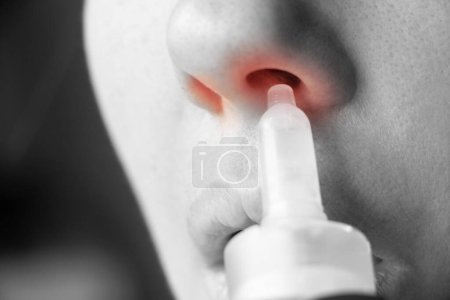 Téléchargez les photos : Fille et nez tombe gros plan, froid et traitement du nez qui coule, nez qui coule - en image libre de droit