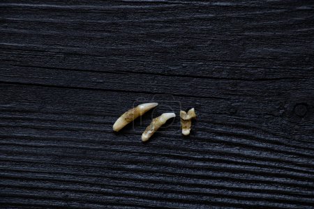 Téléchargez les photos : Trois dents de chat arrachées après une visite chez le dentiste allongées sur un tableau noir, les dents arrachées - en image libre de droit