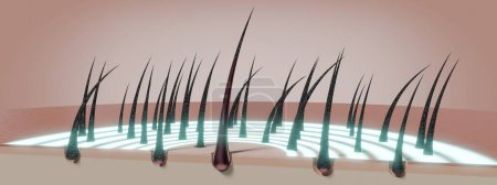 Haarfollikel - Regenerationskonzept - 3D-Illustration