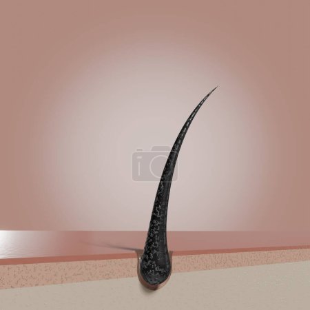 Foto de Folículo de cabello único - Ilustración 3D - Imagen libre de derechos