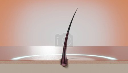 Foto de Folículo de cabello único y brillo redondo - concepto de regeneración - Ilustración 3D - Imagen libre de derechos