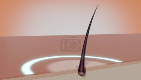 Foto de Folículo de cabello único y brillo redondo - concepto de regeneración - Ilustración 3D - Imagen libre de derechos