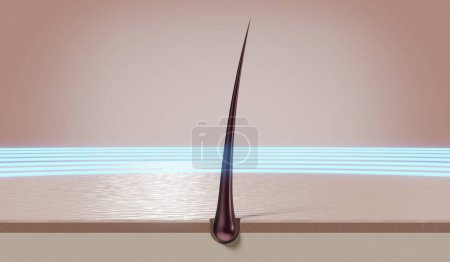 Foto de Folículo de cabello único y brillo - concepto de regeneración - Ilustración 3D - Imagen libre de derechos