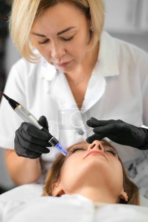 Foto de Mesotherapy with microneedles, beauty injections, face and body care. Hardware procedures for the face. Modern hardware cosmetology, beautician's tools, gloved hands. beauty techniques. - Imagen libre de derechos