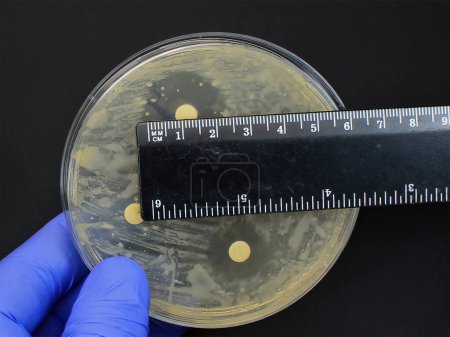 Téléchargez les photos : Tester un antibiotique à l'aide d'un test de diffusion sur disque - Méthode Kirby Bauer - en image libre de droit