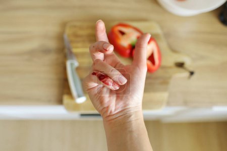 Photo for Woman cut her little finger with knife while cutting red pepper on the kitchen. Close up female hand with red blood. Knife with a sharp blade resulted in cut and wounded finger cooking accident - Royalty Free Image