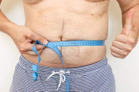Man measures his fat belly with measuring tape and shows thumb up. Concept of weight loss, health problems of obese people. Controlling eating and active lifestyle. World Obesity Day.