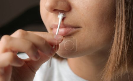 Woman by the ear stick applying medical ointment on inflamed herpes virus under nose. Cold sores with blister healing with antiviral cream. Treating medical condition caused by immune weakness.