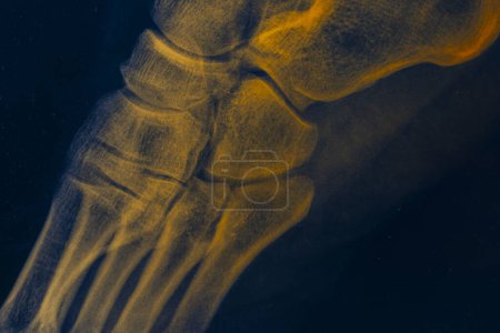 Téléchargez les photos : Détail de la radiographie d'un pied humain - en image libre de droit