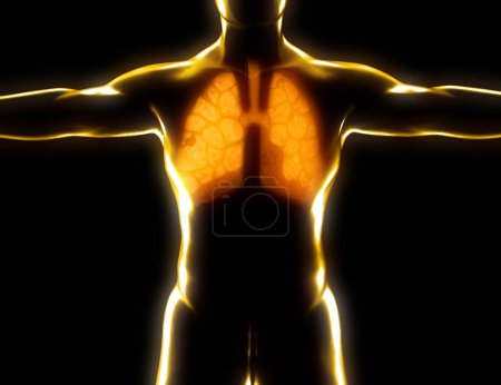 Photo for Human anatomy, problems with the respiratory system, severely damaged lungs. Bilateral pneumonia. Covid-19, coronavirus. Patient and smoke. Smoker. 3d rendering - Royalty Free Image