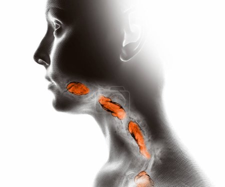 Hals und Muskeln, Speicheldrüsen, Schluckbeschwerden, Verdauungsprobleme. Anatomie des menschlichen Körpers. Dysphagie. Luftröhre. 3D-Darstellung