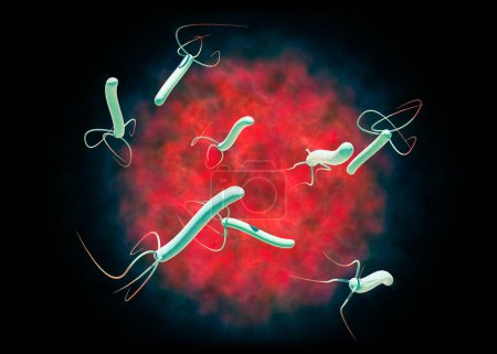 Téléchargez les photos : Helicobacter pylori est une bactérie hélicoïdale flagellée à Gram négatif. Il est capable de coloniser la muqueuse de l'estomac. Rendu 3d - en image libre de droit