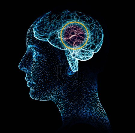 Foto de Cerebro humano y cara de hombre, vista lateral. Rayos X. Enfermedades degenerativas, sinapsis y neuronas, funcionamiento cerebral. Ataque cerebral y problemas cognitivos. Parkinson y Alzheimer. renderizado 3d - Imagen libre de derechos