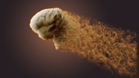 Gehirn von der Seite gesehen. Degenerative Erkrankungen. Degenerative Erkrankungen des Gehirns, Parkinson, Synapsen, Neuronen, Alzheimer, Krankheit, Konzept. 3D-Darstellung