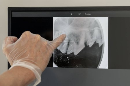 Photo for Enhancing dental care: guided by X-ray precision - Royalty Free Image