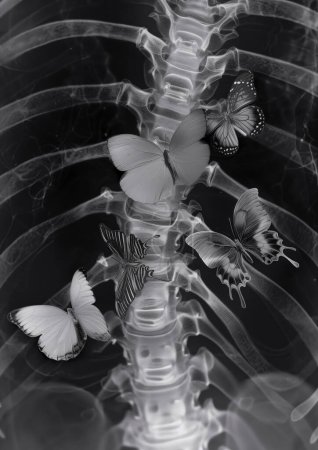Téléchargez les photos : Papillons dans l'estomac x-ray concept fond - en image libre de droit