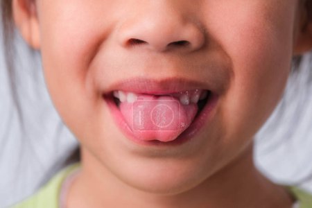 Nahaufnahme eines Mädchens mit gebrochenen oberen Babyzähnen und ersten bleibenden Zähnen. Freundliches kleines Mädchen zeigt ihre kaputten Zähne isoliert auf weißem Hintergrund.