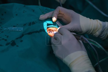 Photo for Doctor surgical operation eye lens replacement, intraocular lens installation, surgical cataract treatment. - Royalty Free Image
