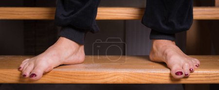 Foto de Close-up of a woman's bare legs below the ankle; Deformation of the toes. - Imagen libre de derechos