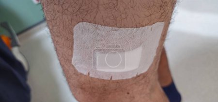 Photo for Leg injured by a cut. Surgical sutures made by a surgeon, Stitches fresh would, hospital and insurance - Royalty Free Image