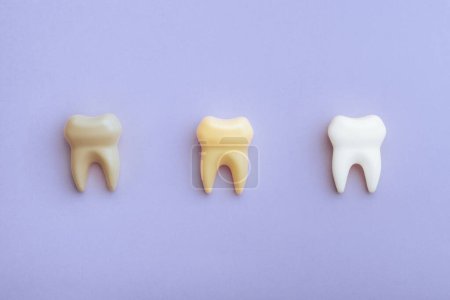 Foto de Imagen del concepto de blanqueamiento dental que cambia los colores de amarillo a blanco - Imagen libre de derechos
