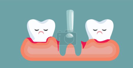 Illustration for Tooth Loss in Oral Health Concept Medical Cartoon Illustration - Royalty Free Image