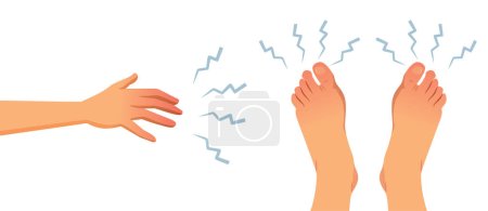 Ilustración de Entumecimiento en extremidades para la ilustración del concepto médico de los pies y de las manos - Imagen libre de derechos