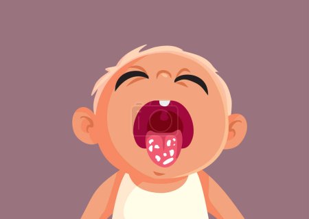 Ilustración de Pequeño bebé sufre de candidiasis Vector ilustración de dibujos animados - Imagen libre de derechos