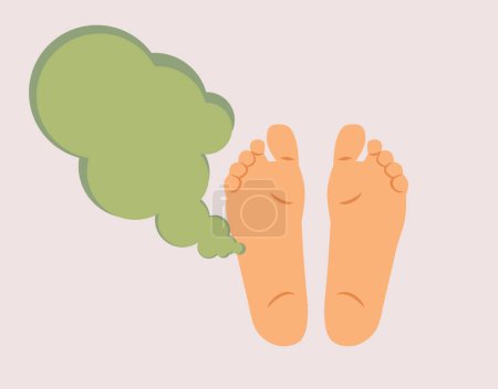 Illustration for Stinky Feet from Medical Reasons Vector Concept Illustration - Royalty Free Image