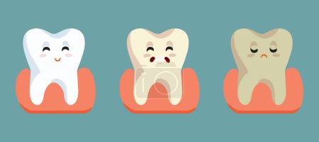 Decaimiento dental Etapas Vector Concepto Dental Médico Ilustración