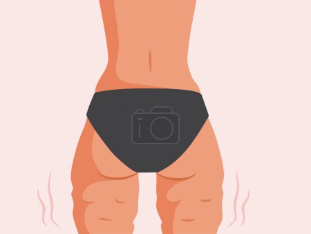 Illustration for Woman With Cellulite Feeling Confident in her Skin Vector Cartoon - Royalty Free Image