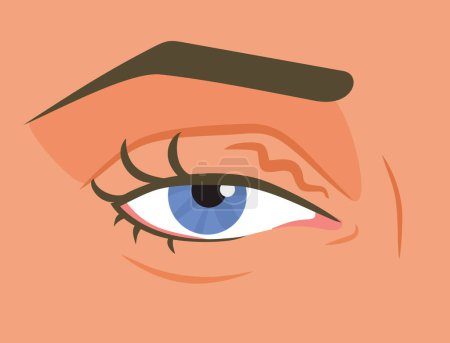 Tired Eye Twitching with Health problems Vector Illustration