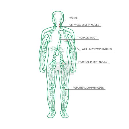 Das Lymphsystem markiert. Lymphknoten und Kanäle in männlicher Silhouette mit Beschreibung. Männliche Silhouette mit Lymphknoten isoliert auf weißem Hintergrund. Vektorillustration.