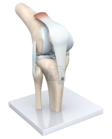 Téléchargez les photos : L'articulation du genou, une charnière complexe, relie l'os de la cuisse (fémur) à l'os du tibia, amorti par le cartilage, permettant la flexion, l'extension et une légère rotation.. - en image libre de droit