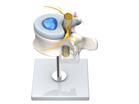 Foto de Ilustración que muestra el modelo de una vértebra lumbar sana con disco y médula espinal. D ilustración - Imagen libre de derechos