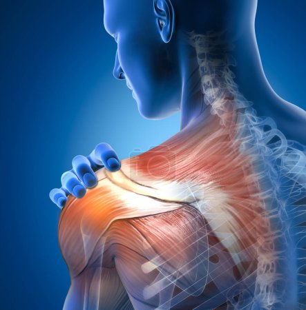 Photo for A painful shoulder joint involves discomfort or soreness, often limiting mobility and affecting daily activities due to various potential underlying causes. - Royalty Free Image