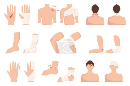 Illustration for Set of Body Injuries, Palm, Finger, Shoulder or Elbow. Leg, Foot, Knee and Head Trauma with Bandage and Blood. First Aid, Bandaging Aid Isolated on White Background. Cartoon Vector Illustration - Royalty Free Image