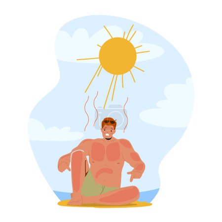 Illustration for Man Grimacing In Pain From Sunburn On Beach, Red And Inflamed Skin, Seeking Relief And Shade From The Scorching Sun. Male Character Injured with Sun Rays. Cartoon People Vector Illustration - Royalty Free Image