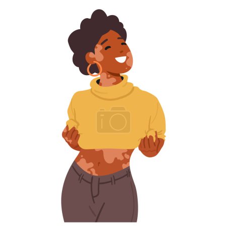 Illustration for Joyous Woman With Vitiligo, Proudly Embracing Her Unique Skin. Character Radiant Smile, Confidence, And Self-love Reflect Her Beauty, Inspiring Acceptance And Positivity. Cartoon Vector Illustration - Royalty Free Image