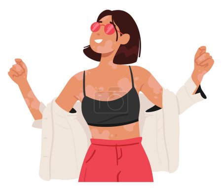 Ilustración de Mujer alegre con vitiligo abraza su belleza única, irradiando confianza y positividad. La sonrisa genuina refleja el amor propio y la resiliencia, inspirando a otros a abrazar la diversidad. Ilustración vectorial - Imagen libre de derechos