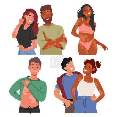 Illustration for Joyful Characters Proudly Embracing Their Unique Beauty. People Celebrating Diversity With Vitiligo. Radiating Confidence, Their Smiles Defy Societal Norms, Fostering Acceptance And Self-love - Royalty Free Image