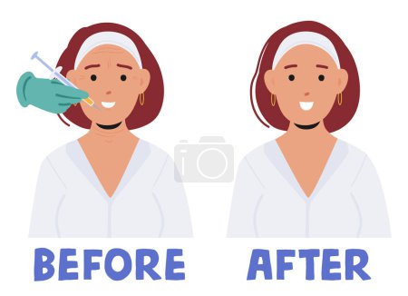 Illustration for Female Face Before and After Beauty Injections. Before, Contours, Expression Lines Visible, Subtle Asymmetries, Signs Of Aging Or Fatigue. After, Smoothed Wrinkles, Plumper Lips, Youthful Appearance - Royalty Free Image