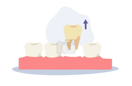 Illustration for Dental medical concept. tooth extraction . Flat cartoon Vector illustration - Royalty Free Image
