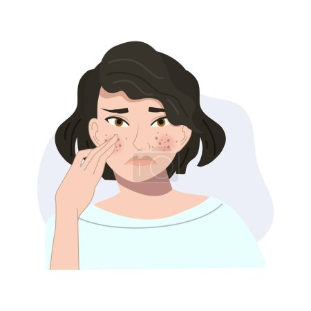 Illustration for Skin Care Concept. Beauty and Insecurities. Portrait of sad and Worried Woman with Acne - Royalty Free Image