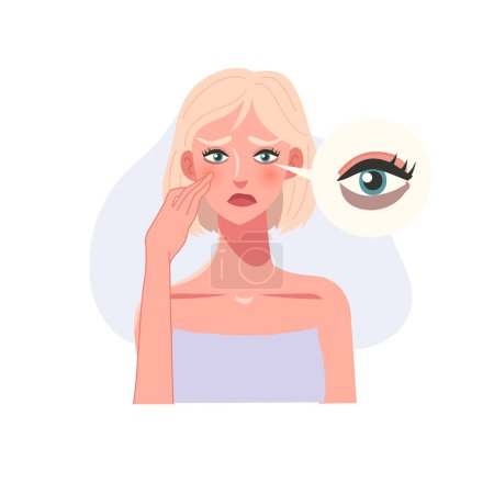 Illustration for Skincare Concept. Worried Woman with dark Circles at eyes - Royalty Free Image