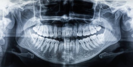 Imagen de rayos X de dientes femeninos