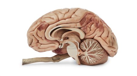 Anatomical model of a human brain with a section cutaway to show internal structures.