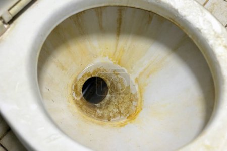 Photo for Close-up shot of a dirty toilet bowl. - Royalty Free Image