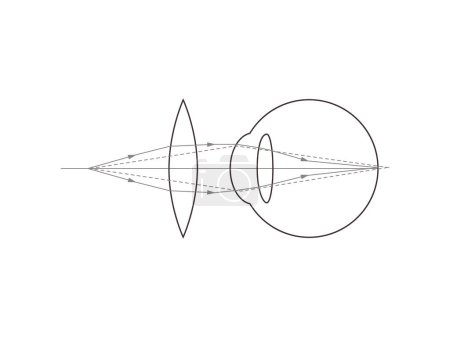 Convex eye lens. Vector scientific illustration. 
