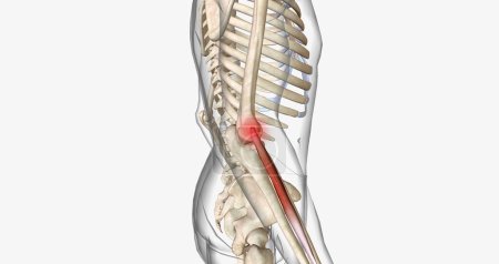 Téléchargez les photos : Tennis elbow, also called epicondylitis, is a painful condition caused by repetitive movement of the elbow. 3D rendering - en image libre de droit